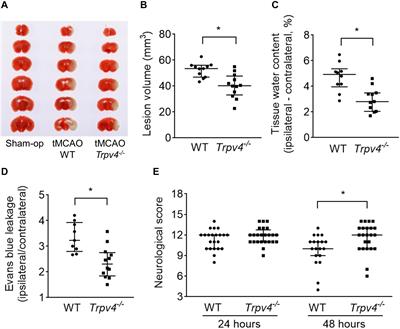 Reduced Post-ischemic Brain Injury in Transient Receptor Potential Vanilloid 4 Knockout Mice